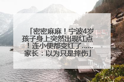密密麻麻！宁波4岁孩子身上突然出现红点！连小便都变红了……家长：以为只是摔伤